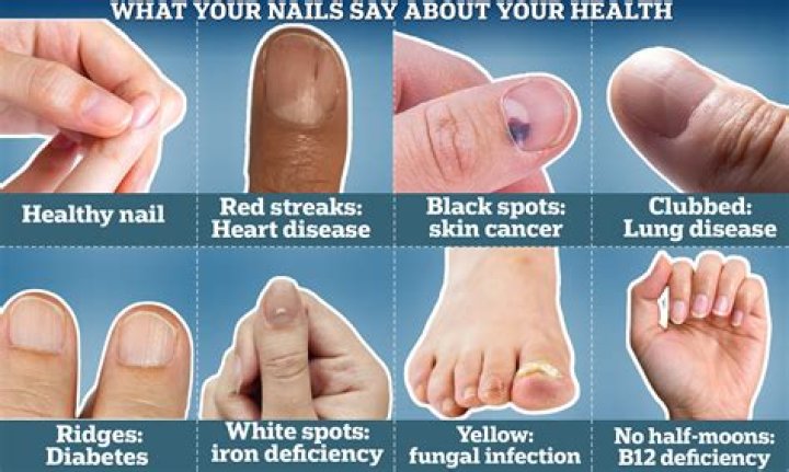 Itches Artie Nails: A Comprehensive Guide to Nail Health and Care